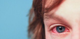 Cuánto dura la conjuntivitis