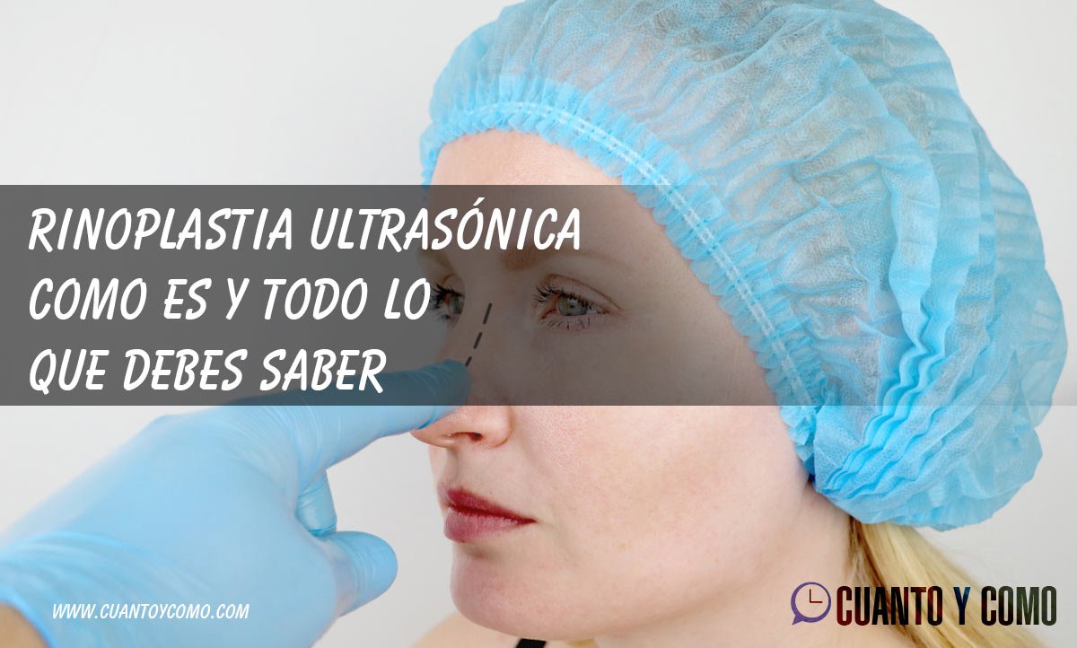 Rinoplastia ultrasónica